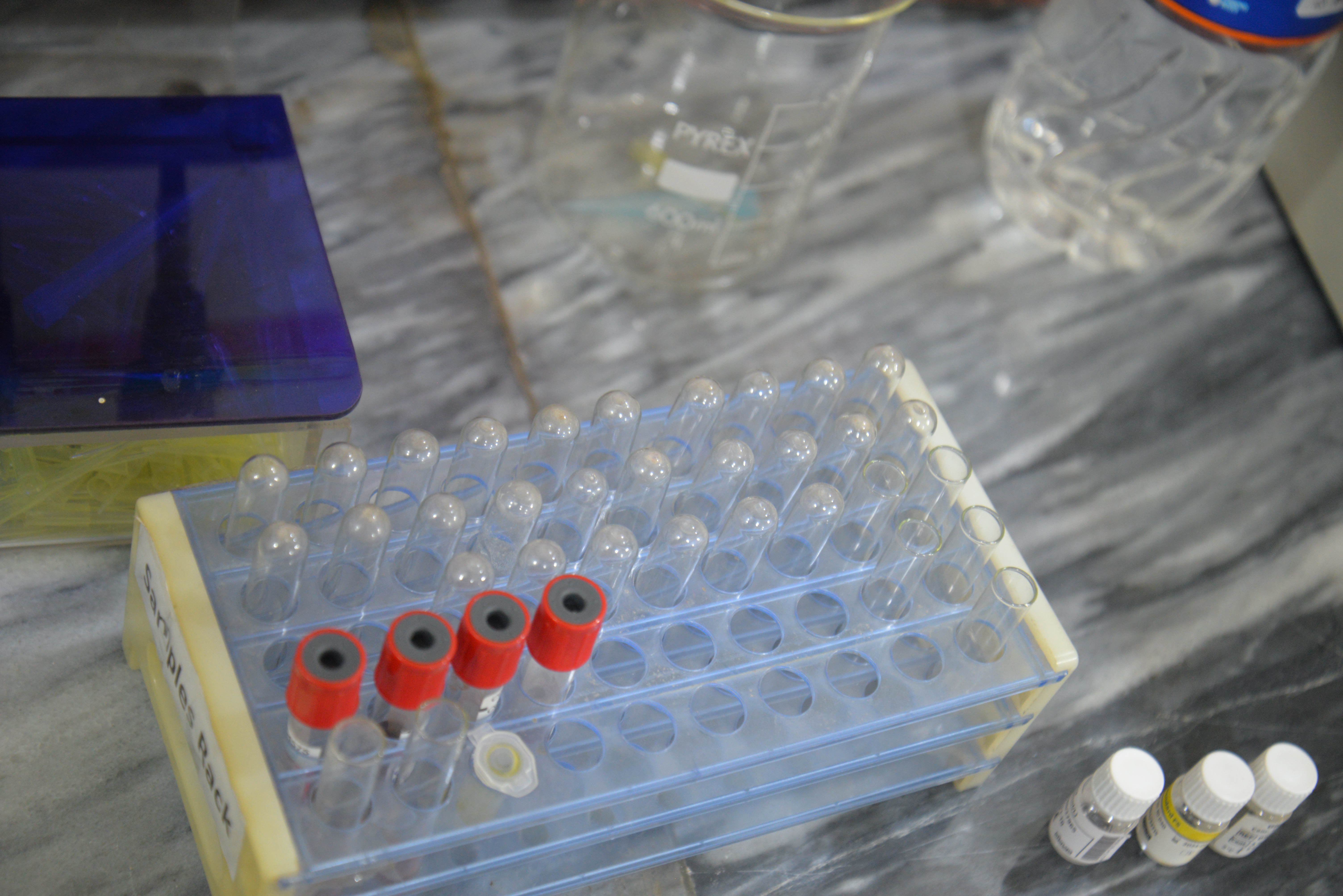 MLT Lab 1